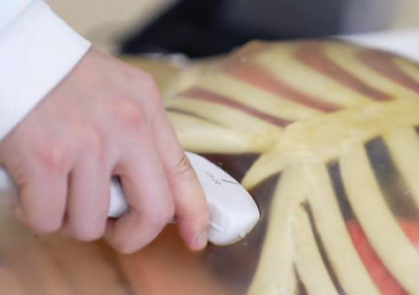 綜合超聲檢查平臺3.0